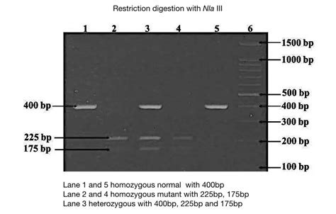 how to read agarose gel electrophoresis results|Part 2: Analysing and Interpreting (Agarose) Gel .